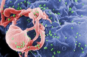 Εμβόλιο κατά του AIDS στα σκαριά – 100% αποτελεσματικότητα δείχνουν οι δοκιμές