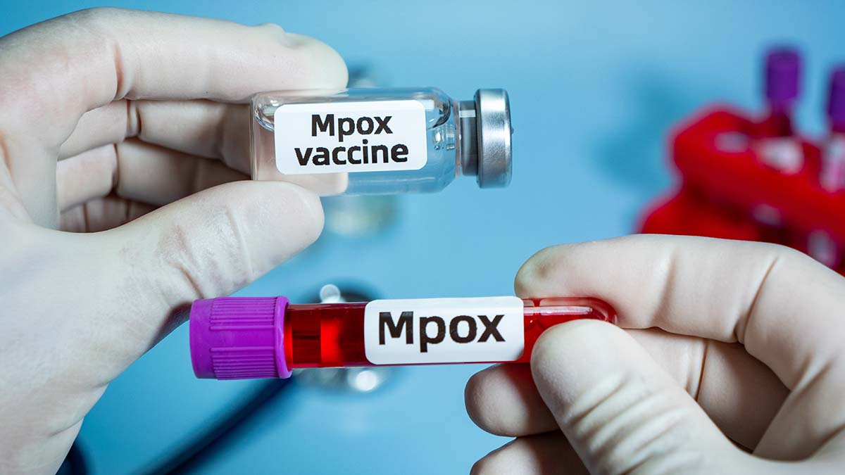 Mpox: 18 επιβεβαιωμένα κρούσματα του ιού στην Ελλάδα μεταξύ Νοεμβρίου και Δεκεμβρίου